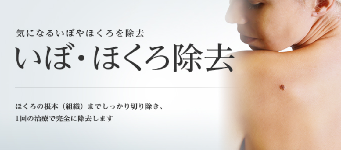 大宮でほくろ除去が評判でおすすめの東京美容外科