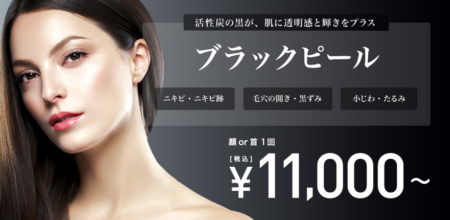 福岡でケミカルピーリングが安いおすすめのTCB東京中央美容外科