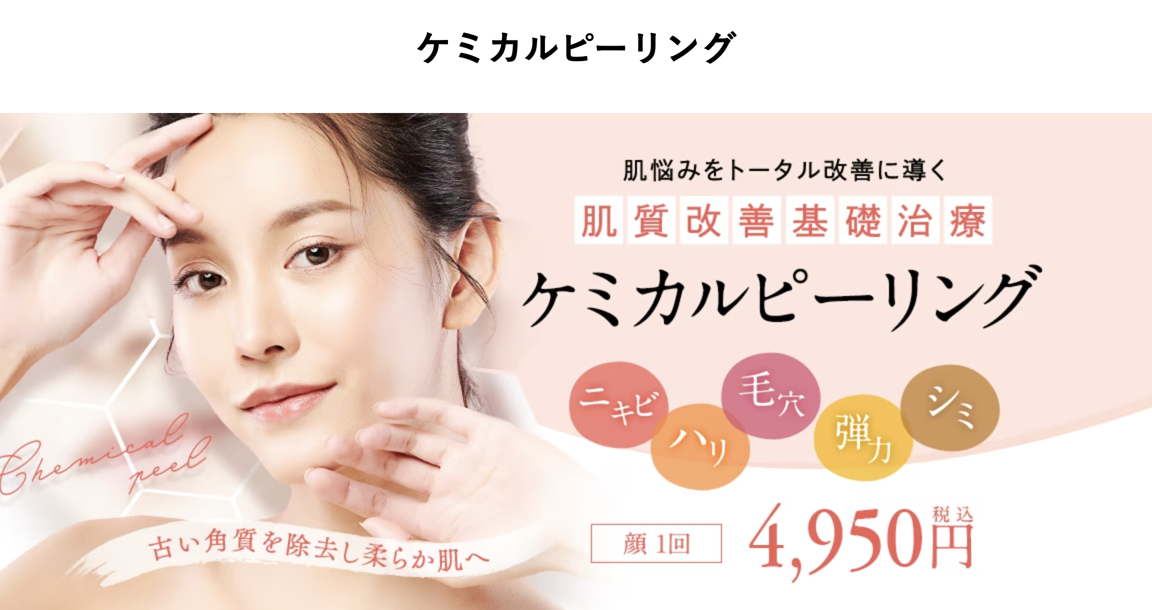 福岡でケミカルピーリングが安いおすすめの湘南美容クリニック