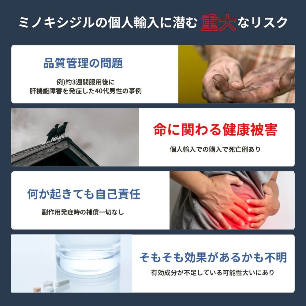ミノキシジルの個人輸入に潜む重大なリスク