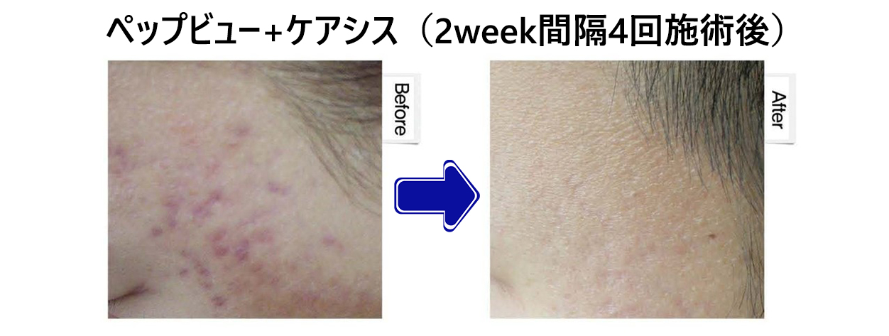 CARESYS