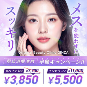 キャンペーン
