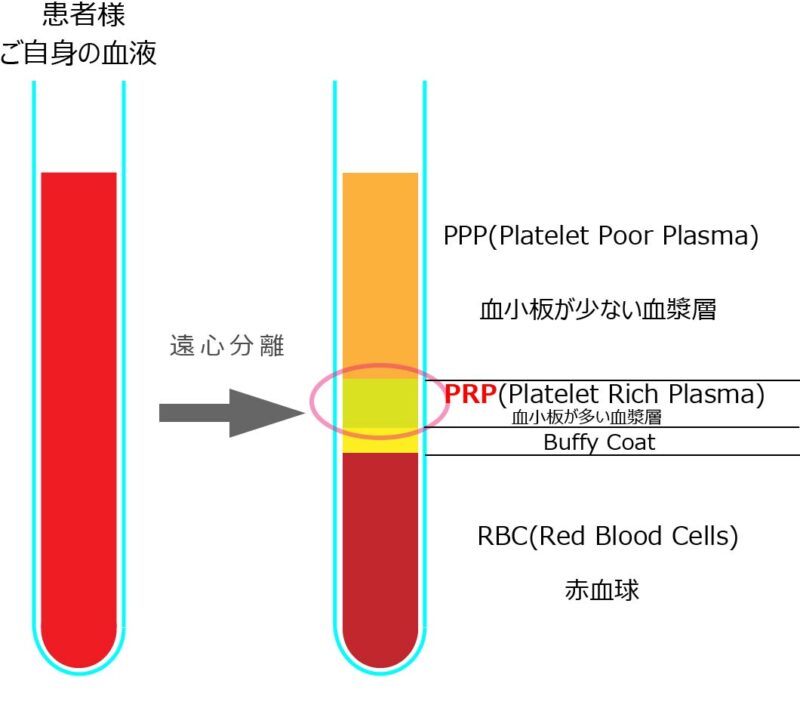 PRP生成の図